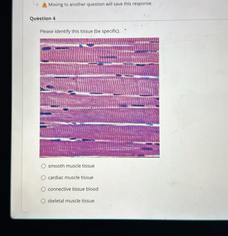 Please identify this tissue (be specific).
smooth muscle tissue
cardiac muscle tissue
connective tissue blood
skeletal muscle tissue