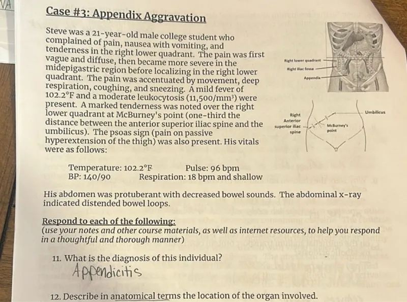 Case #3: Appendix Aggravation
Steve was a 21-year-old male college student who complained of pain, nausea with vomiting, and tenderness in the right lower quadrant. The pain was first vague and diffuse, then became more severe in the midepigastric region before localizing in the right lower quadrant. The pain was accentuated by movement, deep respiration, coughing, and sneezing. A mild fever of 102.2°F and a moderate leukocytosis (11,500 / mm^3) were present. A marked tenderness was noted over the right lower quadrant at McBurney's point (one-third the distance between the anterior superior iliac spine and the umbilicus). The psoas sign (pain on passive hyperextension of the thigh) was also present. His vitals were as follows:
- Temperature: 102.2°F  Pulse: 96 bpm
- BP: 140 / 90  Respiration: 18 bpm and shallow

His abdomen was protuberant with decreased bowel sounds. The abdominal x-ray indicated distended bowel loops.

Respond to each of the following:
11. What is the diagnosis of this individual?

Appendicitis
12. Describe in anatomical terms the location of the organ involved.