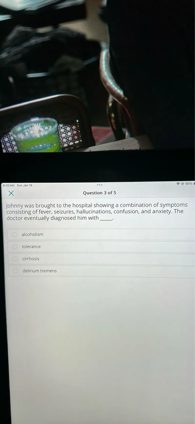 Johnny was brought to the hospital showing a combination of symptoms consisting of fever, seizures, hallucinations, confusion, and anxiety. The doctor eventually diagnosed him with delirium tremens.